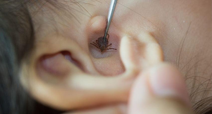 Foreign Body Removal From Ear Nose Throat