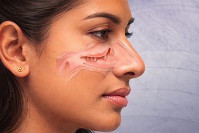 Nasal Polyps Treatment